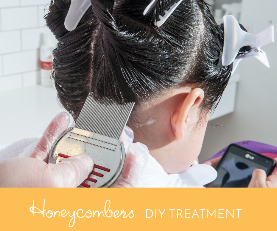 DIY Lice Treatment